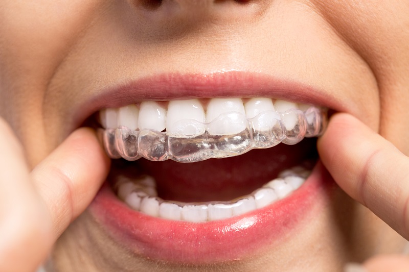 Medycyna spersonalizowana w ortodoncji