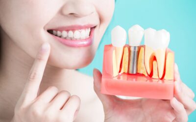 Invisalign® a implanty zębów